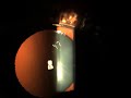 Eye Worm Swimming Onchocerciasis