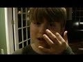 Black-Eye Prank