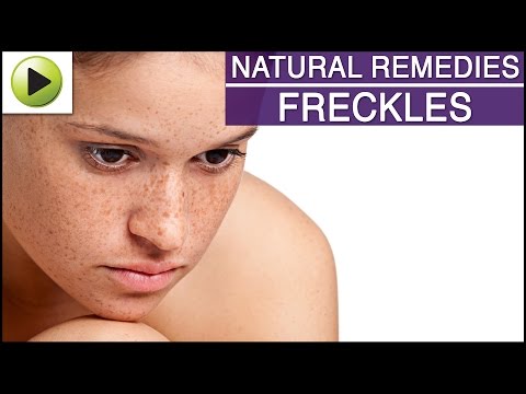 how to treat freckles