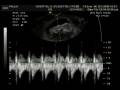 videos de Baby Bianchi-13 semanas