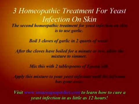 3 Homeopathic Treatment For Yeast ...