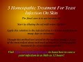 3 Homeopathic Treatment For Yeast Infection On Skin
