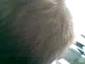 Hair Loss Shane Hair Loss Shane