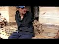 Extraña Enfermedad de la Piel - El Hombre Árbol Extraña Enfermedad de la Piel - El Hombre Árbol