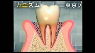 次亜塩素酸の殺菌メカニズム