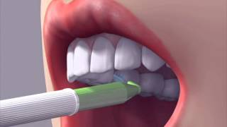 Правильная чистка межзубных промежутков