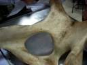 Coxal Equino.MOV Coxal Equino.MOV