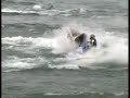 Even Jetskiing can Hurts