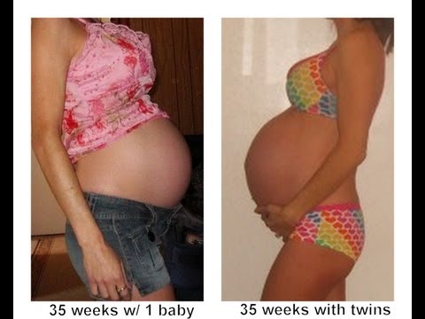 how to know twin pregnancy
