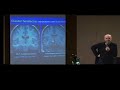 Goadsby Cluster Headaches 2 of 8