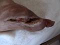 Debridement - 2