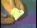 Maxillary Sectional Tray Impression