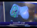MAKO Surgical Robot