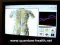 METATRON NON-LINEAR BODY SCANNING TECHNOLOGY.
