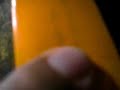 puffy lipo