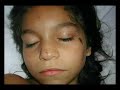 testimonio de una ni�a salvada de 1 acidente