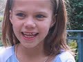 Loose Tooth "Pull Out"