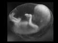 Little Baby - ProLIFE Music Video