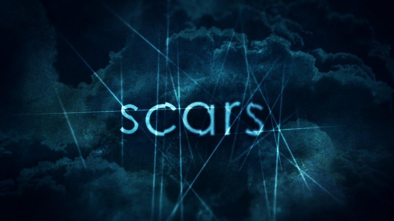 Dan Stevers – Scars