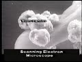 Second Wind Air Purifiers - Dust Mites Second Wind Air Purifiers - Dust Mites