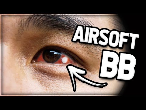 KID Gets Airsoft BB To The Eye! (GETS STUCK)