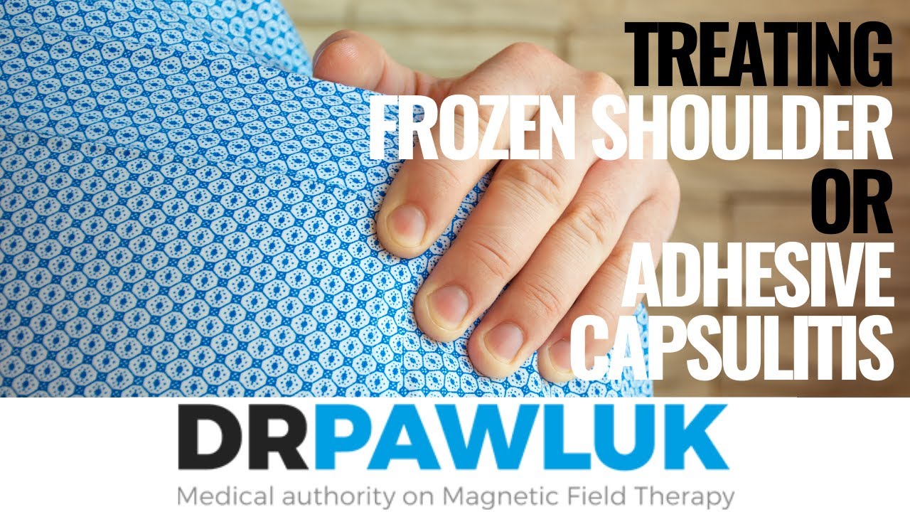 PEMF Therapy for Frozen Shoulder or Adhesive Capsulitis