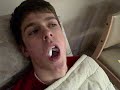 Weston and Jakob Wisdom Teeth  (12).AVI