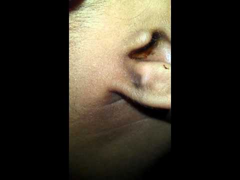 how to remove ear wax with a qtip
