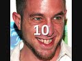 Top ten worst teeth!