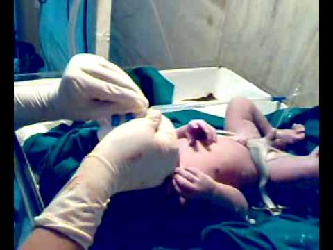 Neonatal care - YouTube