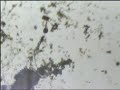 ekmek k�f mantar? mikroskobik