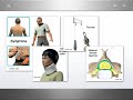 Dr Alexandre Henrique - aula PG fisioterapia - coluna cervical - CESUMAR