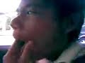 koyak bibir...