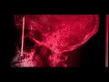 Nemesis Star - Eclipse Of Sorrow