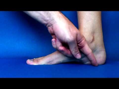 how to rebuild arches in flat feet