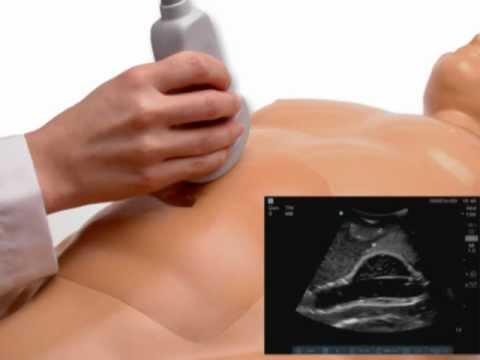 how to perform aortic ultrasound