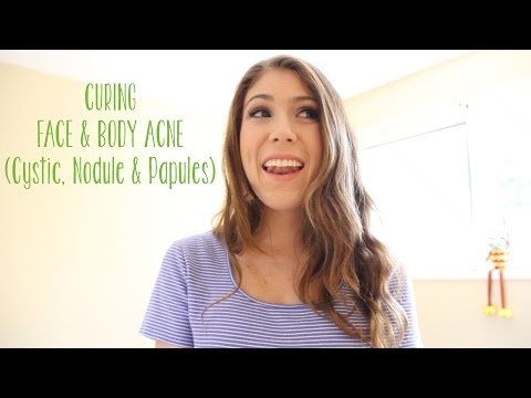 how to detox for acne