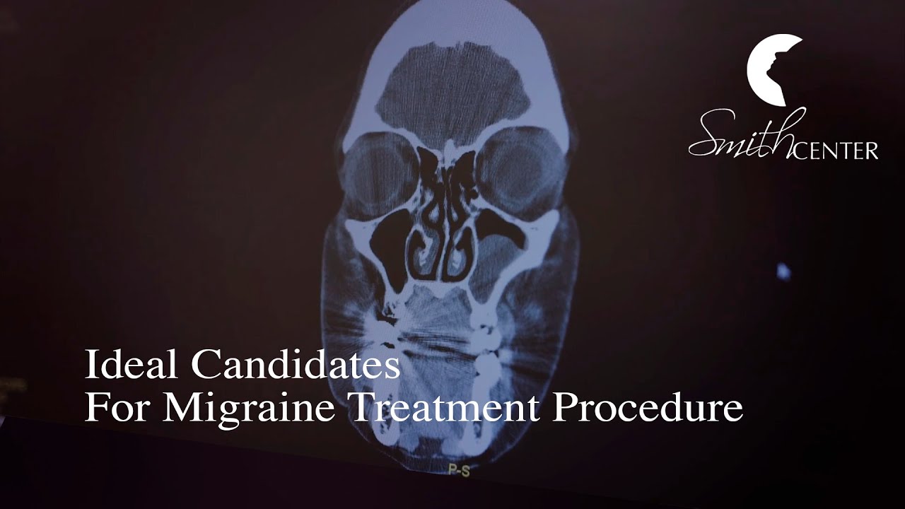Ideal Candidates for Migraine Treatment Procedure -­ Houston Smith Center