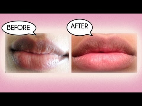 how to whiten dark lips