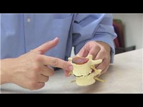 how to repair herniated disc