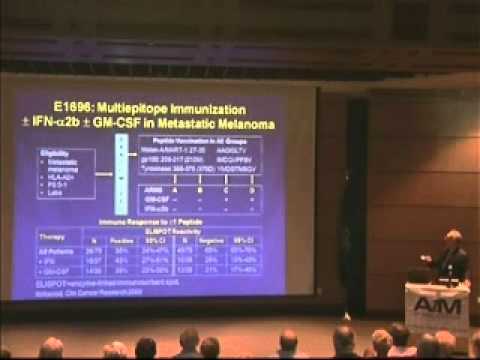 History of Melanoma Immunotherapy – From Freund to Ipilimumab