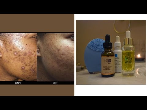 Updated Skin Care Routine