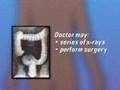 PreOp® Patient Education Endoscopy of Large Intestine II