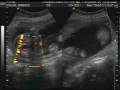 videos de AddiSono12-4-08.wmv