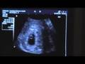 Baby Hosch Week 6 Day 2 04-10-2008