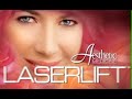 LaserLift