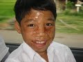 A beautiful Vietnamese song with images from Clear Path International's work with present day victims of landmines and bombs leftover from the Vietnam War.Learn more at www.cpi.org