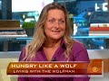 Real-Life Wolfman Real-Life Wolfman