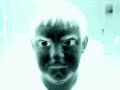 crazy eyes in xray crazy eyes in xray