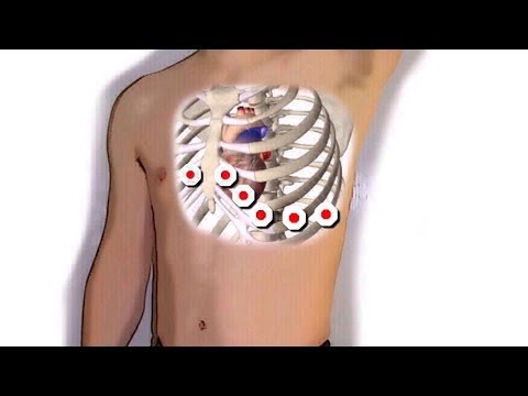 how to apply ecg leads